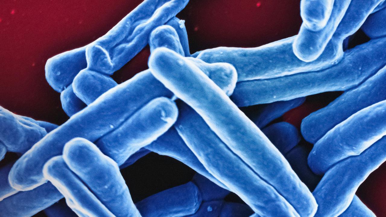 TB shown in microscopic image; blue on red background